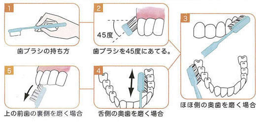 歯磨きの仕方